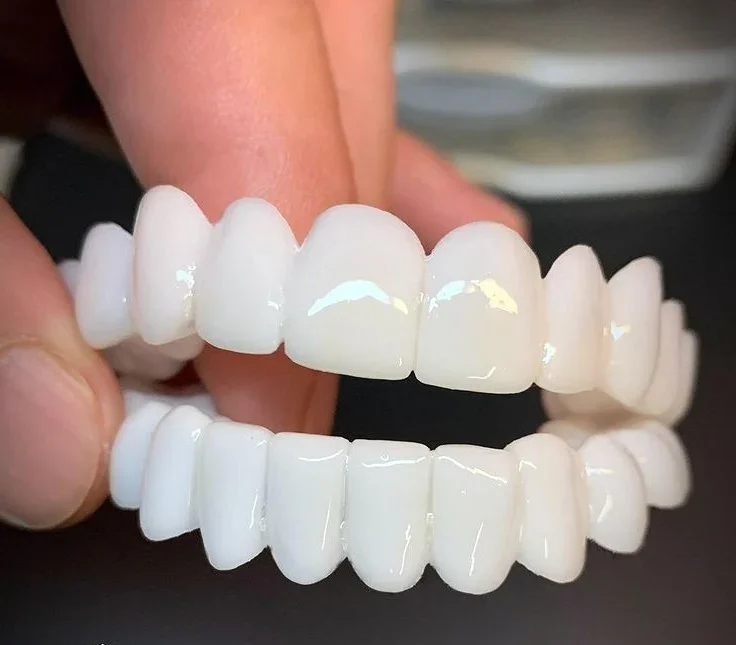 Smile Lens – Verstellbare weiße Zahnprothese für sofortige Lächelnkorrektur | Karnz